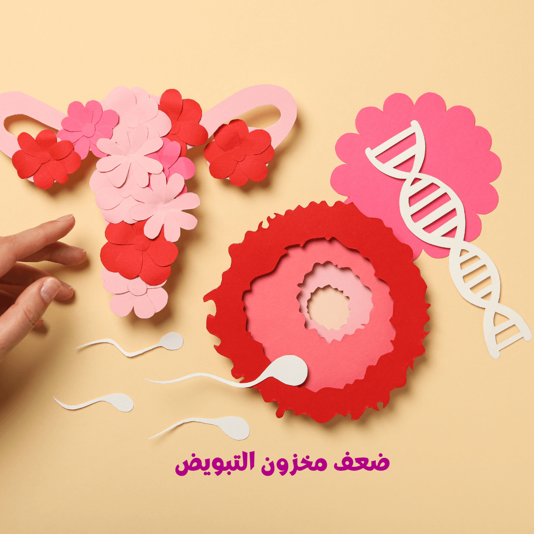 قصة نجاح عملية الحقن المجهري وضعف مخزون التبويض